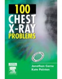 100 Chest X-Ray Problems