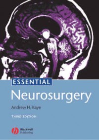 Essential Neurosurgery : Third Edition