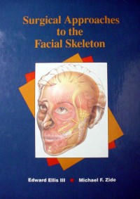 Surgical Approaches tp the Facial Skeleton