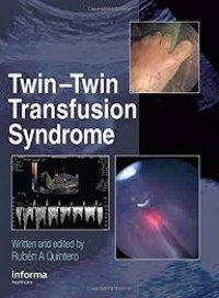 Twin-twin transfusion syndrome