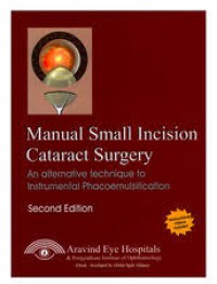Manual Small Incision Cataract Surgery ; an alternative Technique to instrumental phacoemulsification.