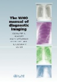 TheWHO manual of diagnostic imaging : Radiographic Anatomy and Interpretation of the Chest and the Pulmonary System.