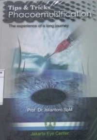 Tips & Tricks Phacoemulsification